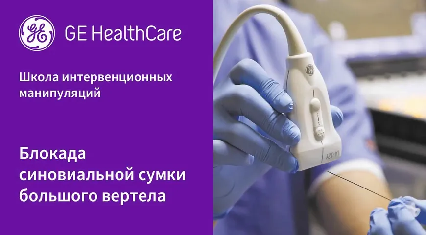Блокада синовиальной сумки большого вертела