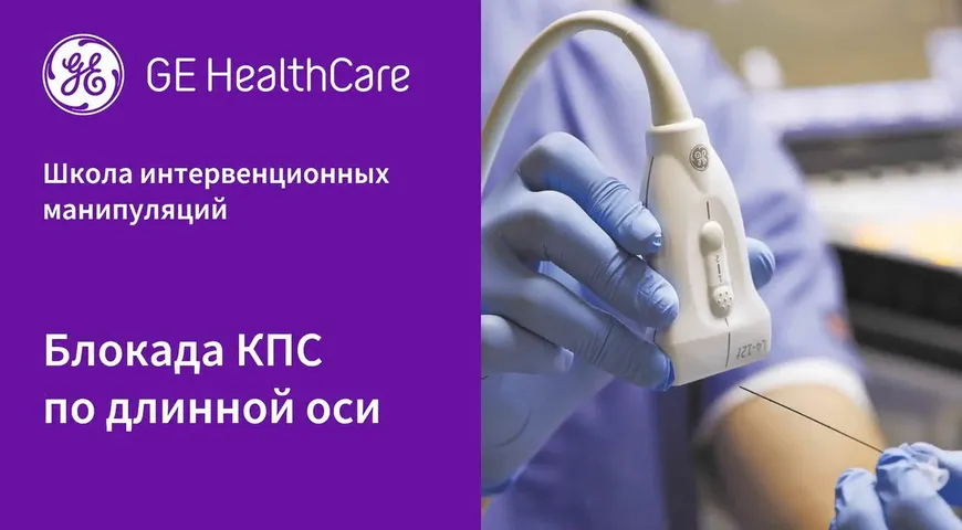 Блокада КПС по длинной оси