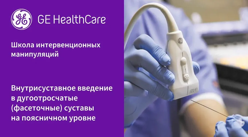 Поясничные фасеты внутрисуставное введение