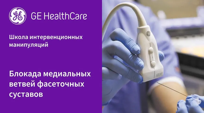 Блокада медиальных ветвей фасеточных суставов