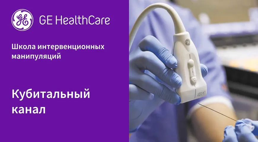 Кубитальный канал