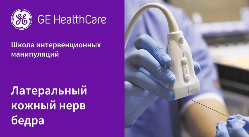 Латеральный кожный нерв бедра