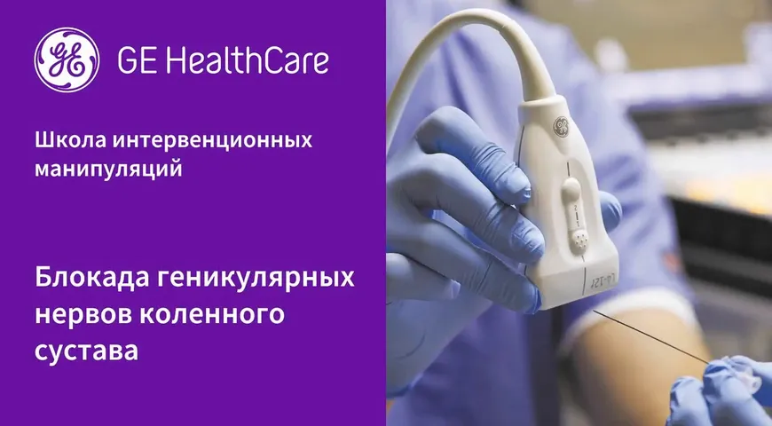 Блокада геникулярных нервов коленного сустава