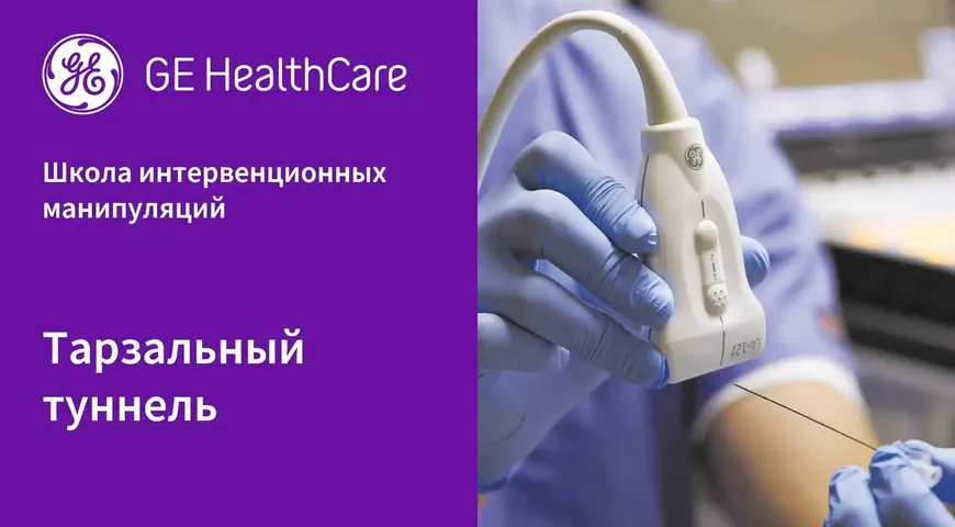 Тарзальный туннель