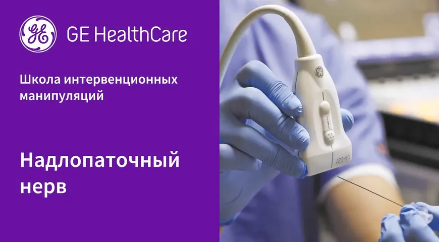 Надлопаточный нерв