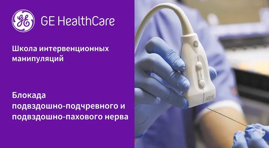 Подвздошно подчревный паховый нервы