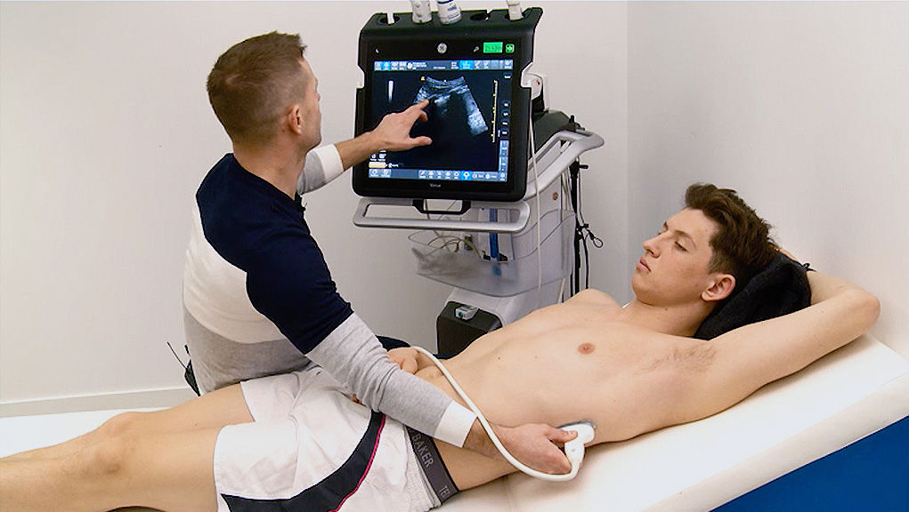 Positioning the probe at the postero-lateral point