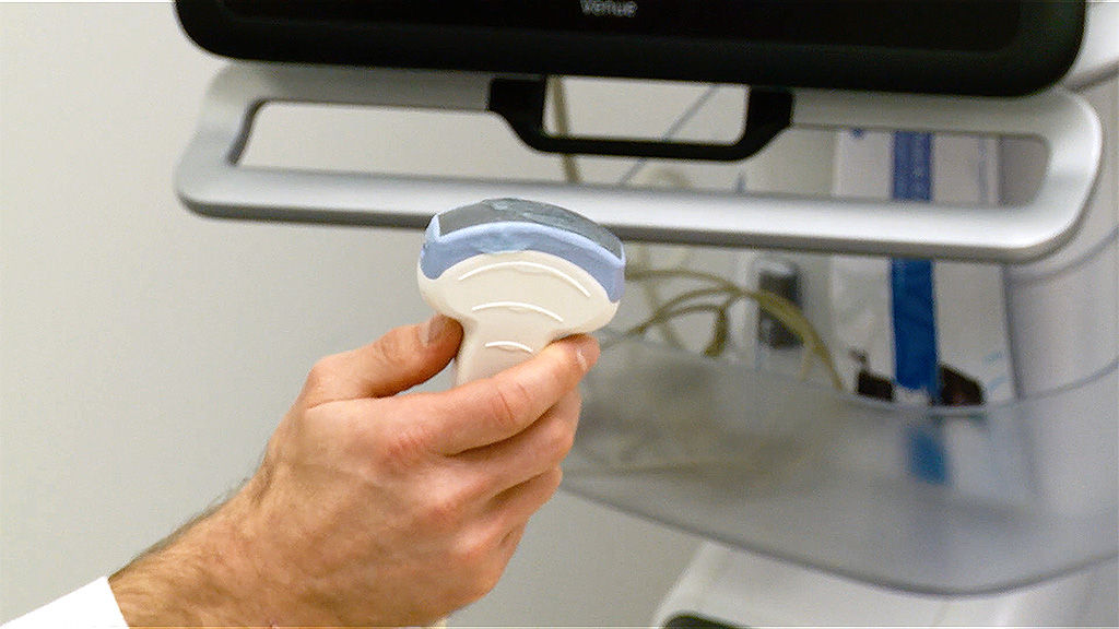 The curvilinear probe is ideal for lung ultrasound