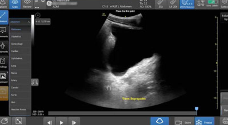 Why and How to Perform the eFAST Examination in the Trauma Setting