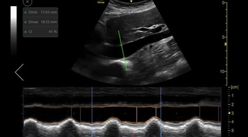 GE Healthcare Goals for Using AI with Point of Care Ultrasound