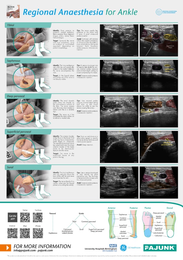 Regional Anaesthesia For Ankle