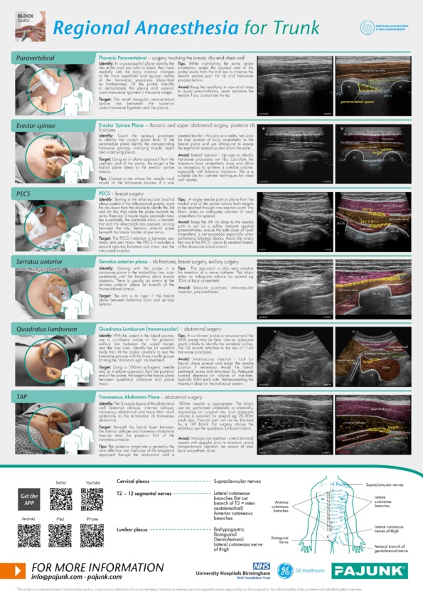 Regional Anaesthesia For Trunk