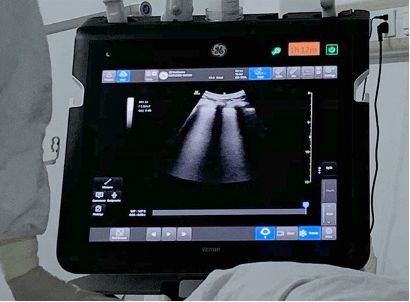 Algorithms for Emergency Point of Care Ultrasound