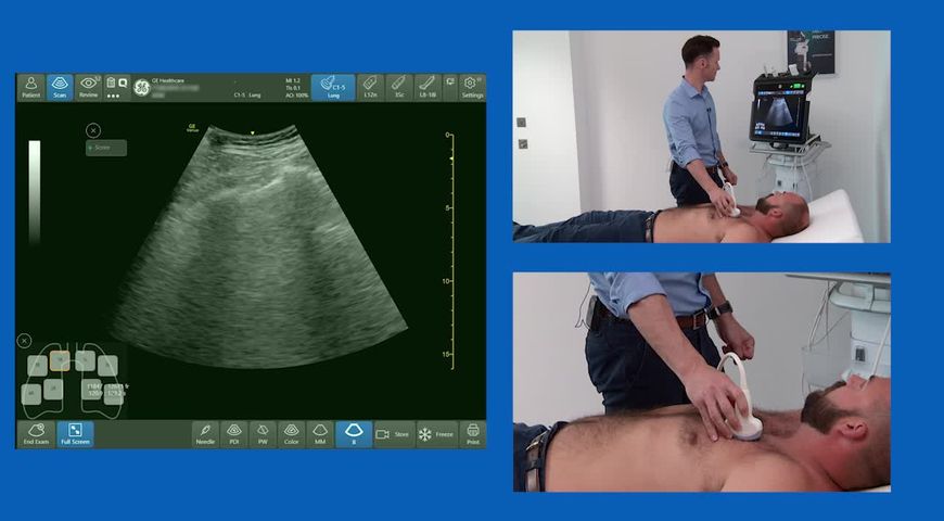 How to Perform Ultrasound of the Lungs