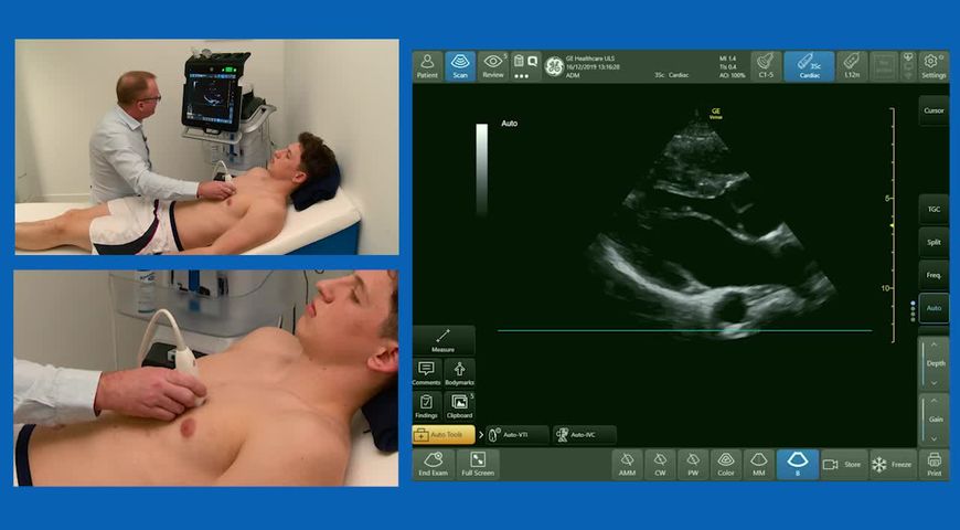 How to assess the right ventricle