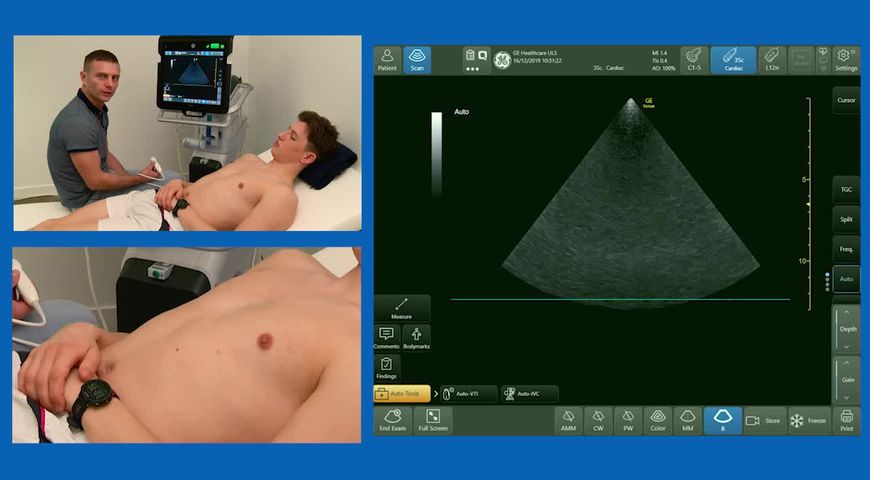 How to assess volume status