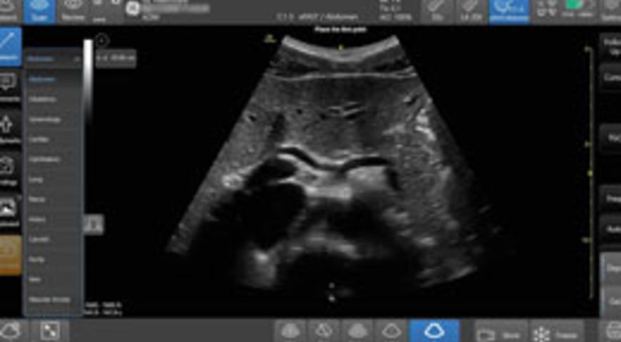 How to recognise and assess the Abdominal Aorta.