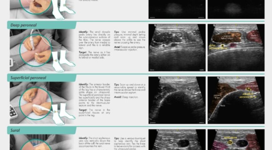 Regional Anaesthesia For Ankle