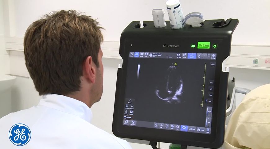 Comment évaluer les pressions de remplissage du ventricule gauche