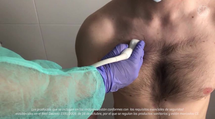 Exploración ecográfica Pulmonar anterior y lateral