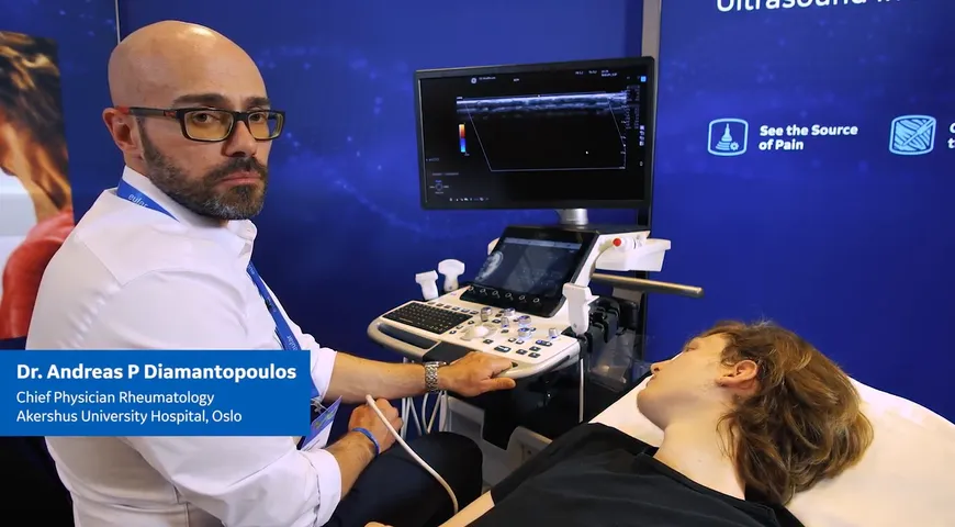 Making diagnosis of GCA easy