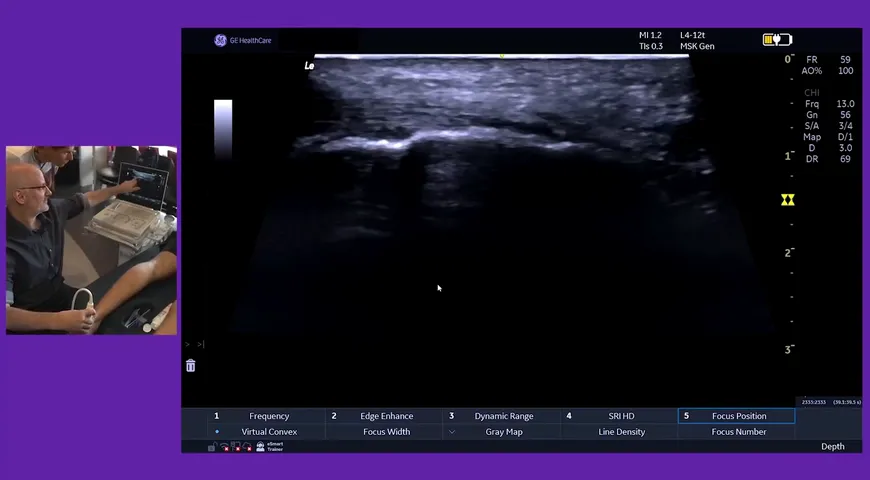 Assessing the Achilles tendon, and the surrounding structures, for football injuries with Robert Laus
